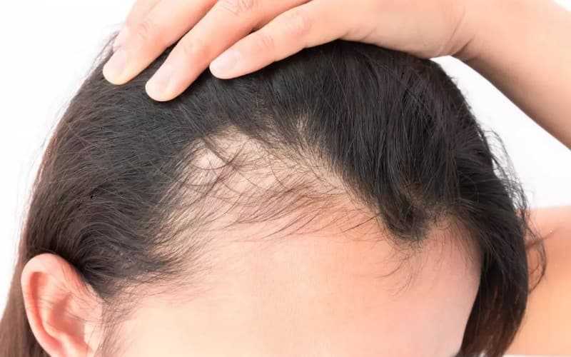 Холодный ботокс для волос [что это такое] — плюсы и минусы процедуры холодного восстановления