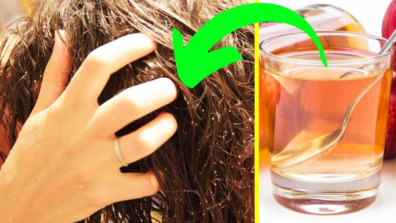 Как сделать волосы светлее уксусом