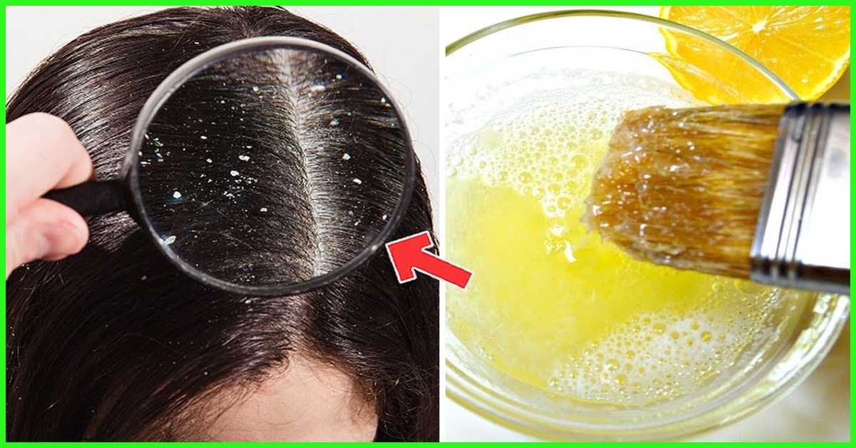 Как избавиться от волос с помощью продуктов