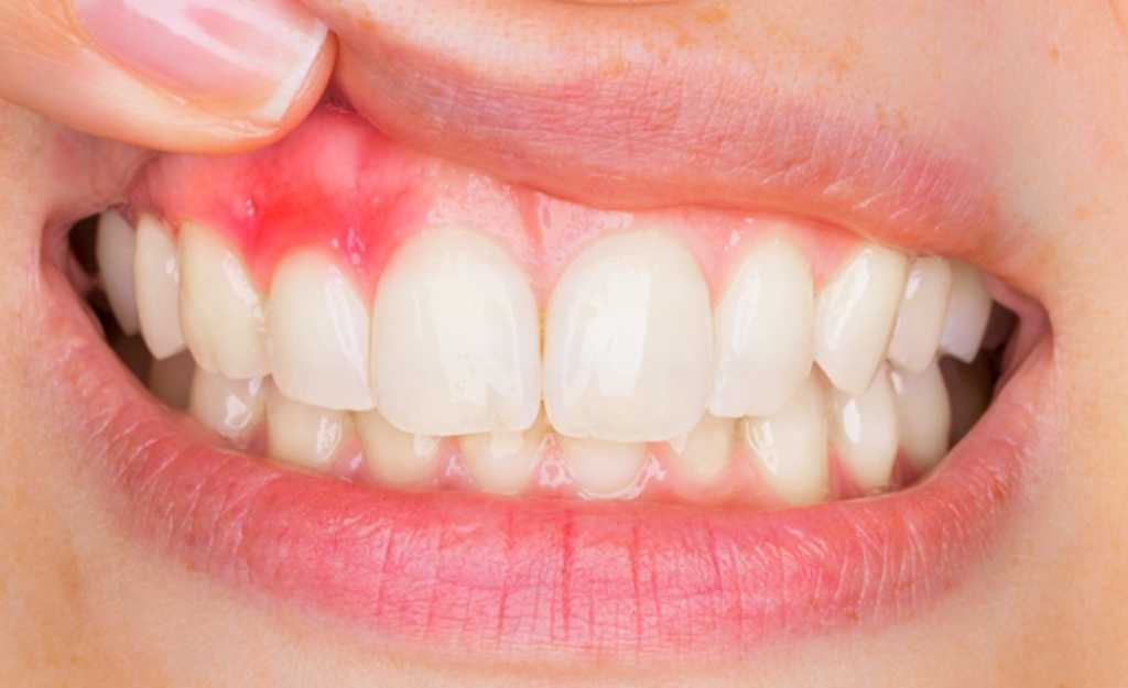 Зубная нить и ее использование