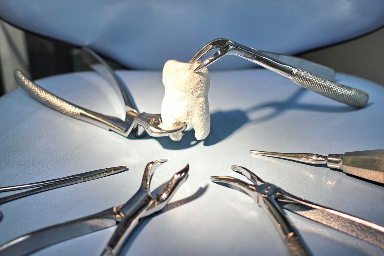 Сложное удаление зуба. Хирургическая стоматология. Хирургия стоматология.