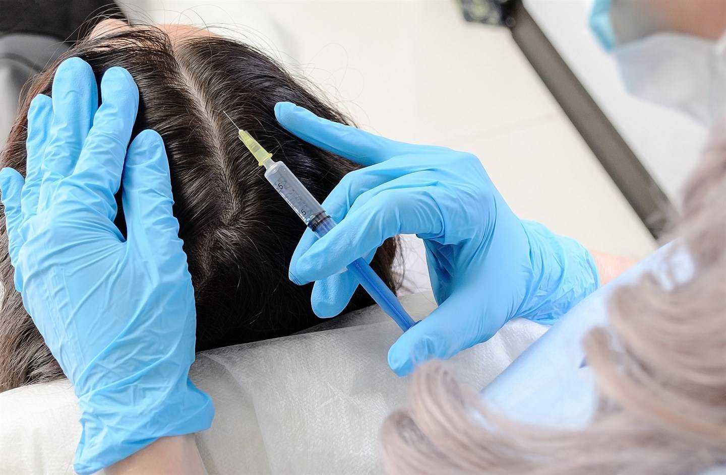 Плазмотерапия волос: плюсы и минусы