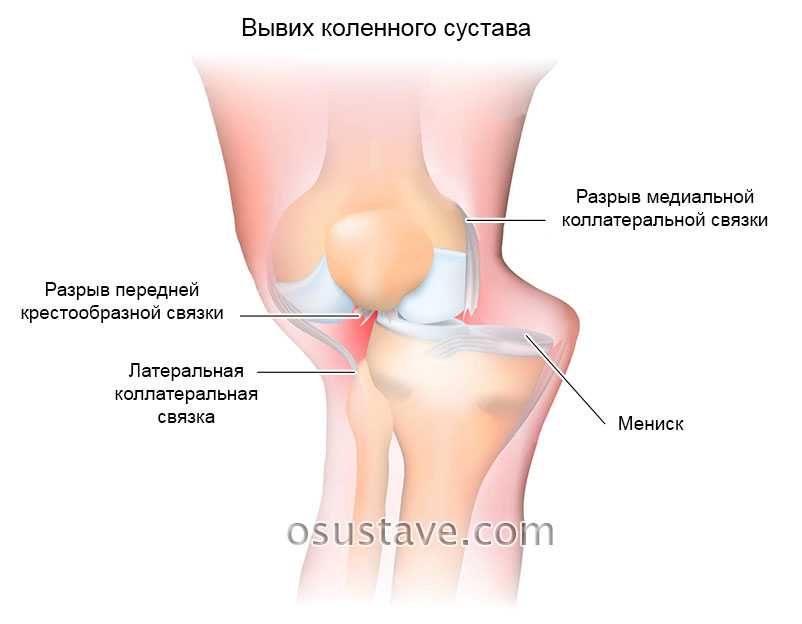 Очень сильно болит колено что делать. Коленный сустав. Чашечка коленного сустава. Боль под коленной чашечкой. Сустав колена.