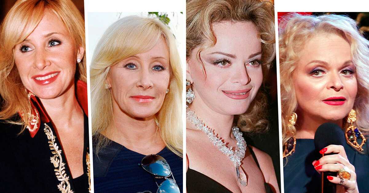 Актеры и актрисы, ставшие жертвами пластической хирургии