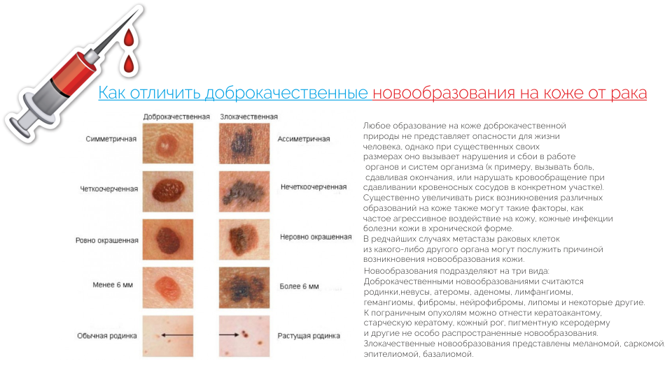 Дерматоскопия: виды дерматоскопов, принцип работы и клинические случаи | портал 1nep.ru