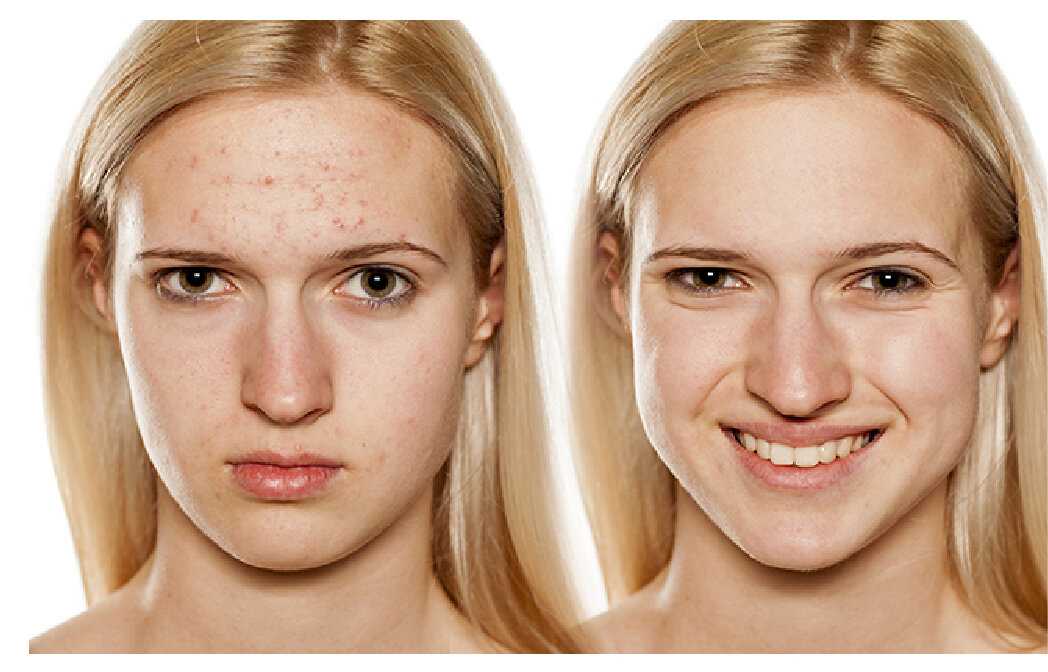 Самые полезные продукты для кожи лица — блог mygenetics
