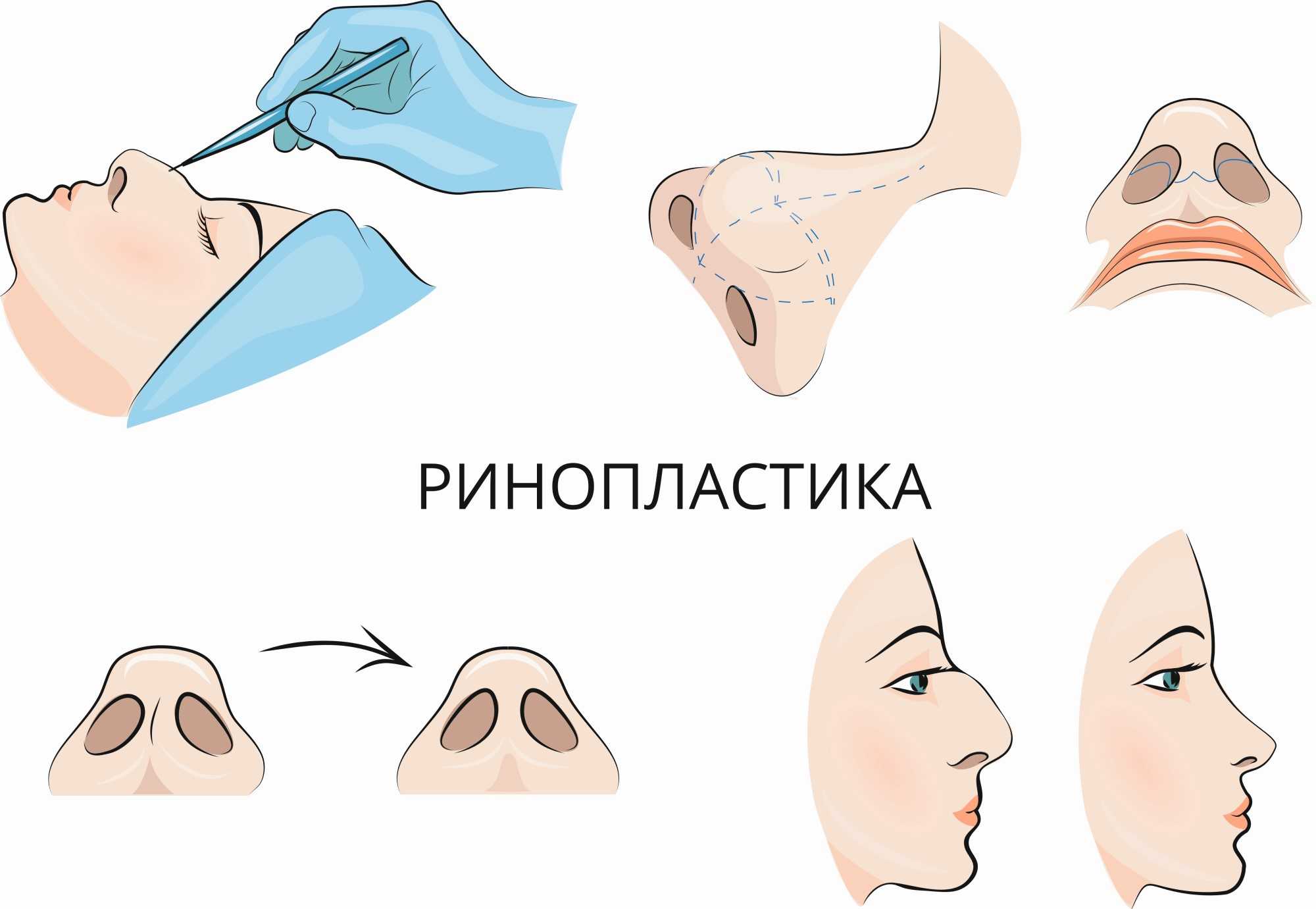 Чем рисуют нос косметика