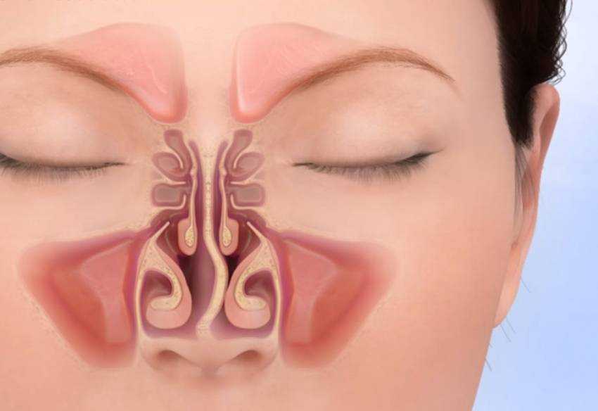 Причины и лечение заложенности носа без насморка, как лечить заложенность носа у взрослых