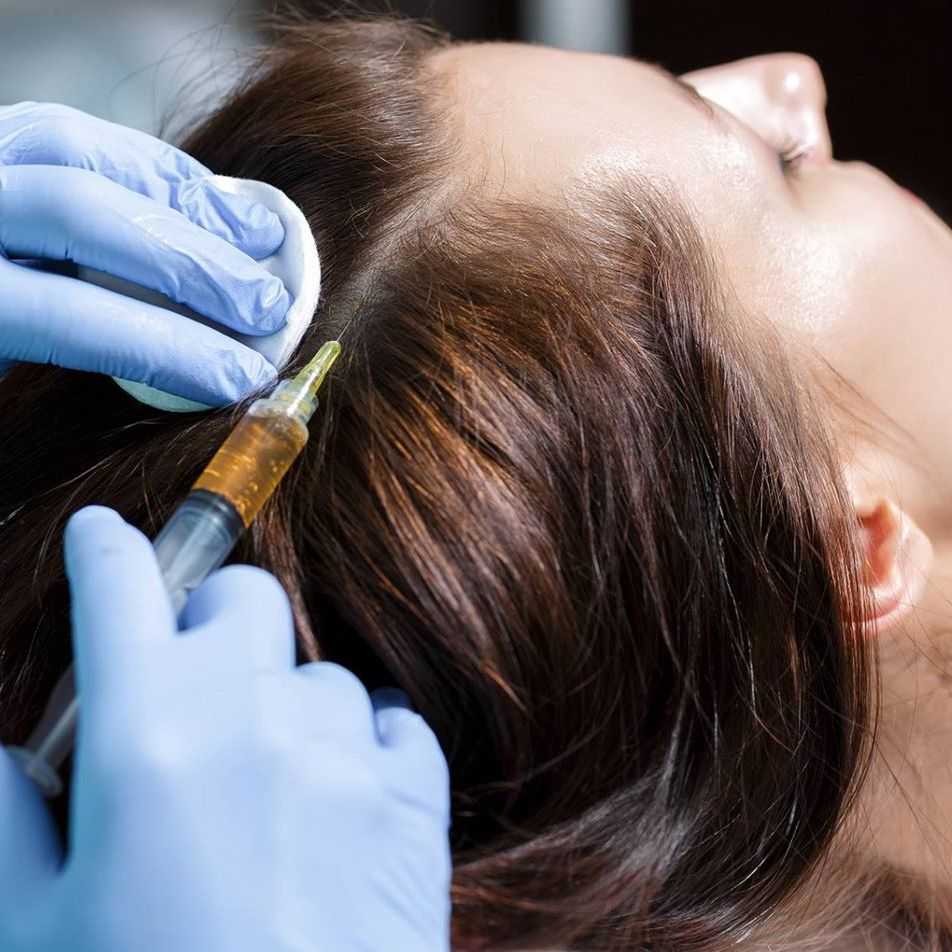 Пересадка волос: подготовка, методы проведения операции | food and health