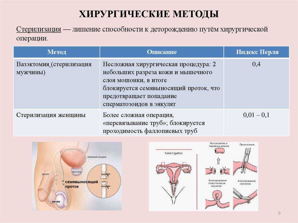 Перевязка маточных труб (женская стерилизация): достоинства и недостатки этого метода контрацепции.