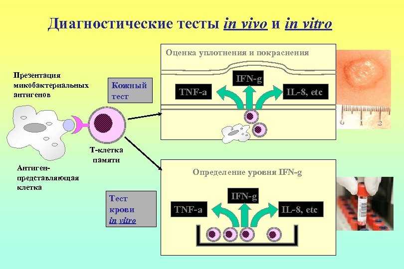 In vivo. In vivo и in vitro что это такое. Методы аллергодиагностики in vivo и in vitro. Методы in vivo. Методы аллергодиагностики in vitro.