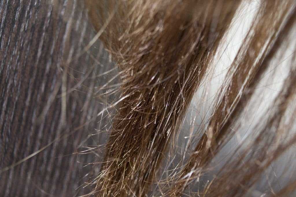 Поврежденные и здоровые волосы