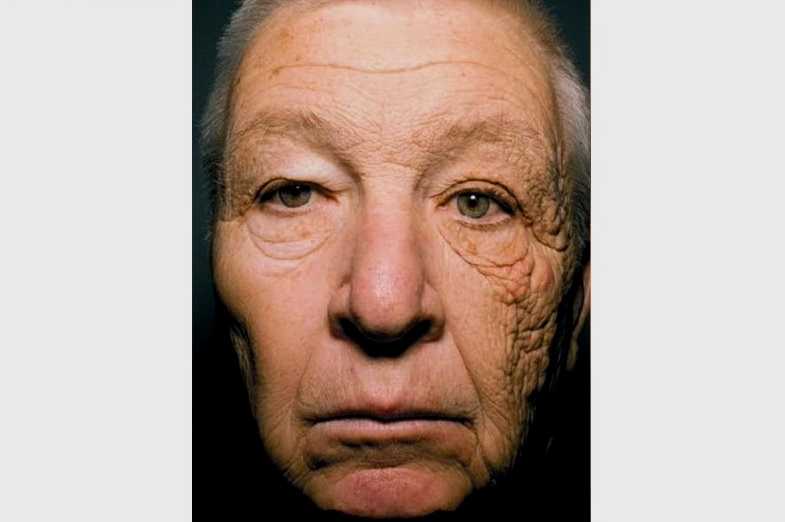 Типы старения кожи и процедуры способные их скорректировать | клиника "отражение"