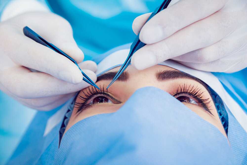 Блефаропластика азиатских глаз (сингапури) – операция по европеизации век в спб